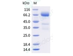 Sino Biological Recombinant Human Glypican 3/GPC3 Protein (His Tag), HPLC-verified,