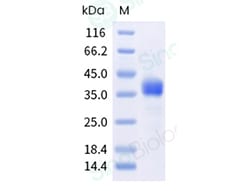 Sino Biological Recombinant Human PD-L1/B7-H1 Protein (AVI Tag), Biotinylated,