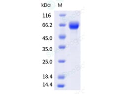 Sino Biological Recombinant Human PD-L1/B7-H1 Protein (ECD, hFc Tag), HPLC-verified,