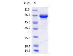 Sino Biological Recombinant Human MMP-2 Protein, HPLC-verified, Quantity: