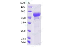 Sino Biological Recombinant Human IL-27 Protein (His Tag), Quantity: Each