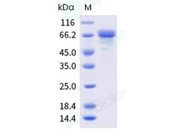 Sino Biological Recombinant Human Cadherin-11 Protein (His Tag), HPLC-verified,