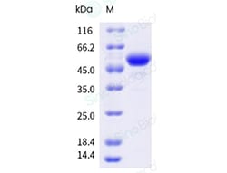 Sino Biological Recombinant Human BAFF/BLyS/TNFSF13B Protein (ECD, AVI