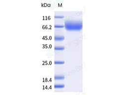 Sino Biological Recombinant Human TrkB Protein (His Tag), Amine-Labeled