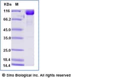 Sino Biological Recombinant Human CD166/ALCAM Protein (ECD, hFc Tag), HPLC-verified,