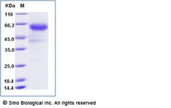 Sino Biological Recombinant Human 4-1BB/CD137 Protein (ECD, hFc & AVI Tag),