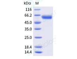 Sino Biological Recombinant Human 4-1BB/CD137 Protein (ECD, hFc Tag), HPLC-verified,