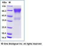 Sino Biological Recombinant Human CD27/TNFRSF7 Protein (hFc & AVI Tag),