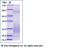 Sino Biological Recombinant Human GM-CSF/CSF2 Protein, Amine-Labeled Biotinylated,