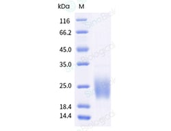 Sino Biological Recombinant Human GM-CSF/CSF2 Protein, HPLC-verified, Quantity: