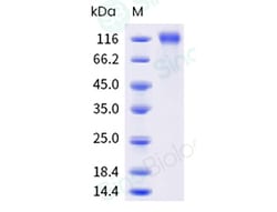 Sino Biological Recombinant Human VEGFR2/KDR Protein (ECD, His & AVI Tag),