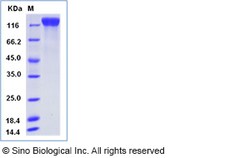 Sino Biological Recombinant Human VEGFR2/KDR Protein (His Tag), Amine-Labeled
