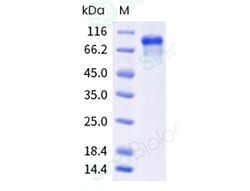 Sino Biological Recombinant Human VEGFR2/KDR Protein (ECD, hFc Tag), HPLC-verified,