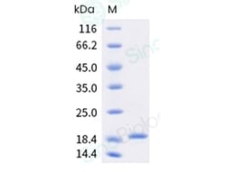 Sino Biological Recombinant Human G-CSF Protein (Isoform b), HPLC-verified,