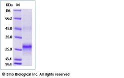 Sino Biological Recombinant Human Her2/ERBB2 Protein (ECD, His Tag), Amine-Labeled