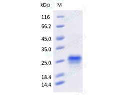Sino Biological Recombinant Human Her2/ERBB2 Protein (ECD, domain IV, His