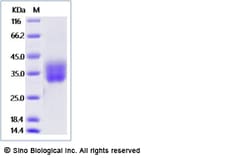 Sino Biological Recombinant Human Her2/ERBB2 Protein (ECD, His Tag), Amine-Labeled