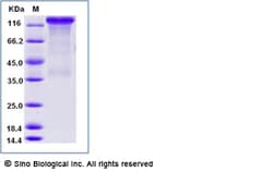 Sino Biological Recombinant Human Her2/ERBB2 Protein (hFc Tag), Amine-Labeled