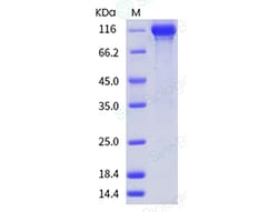 Sino Biological Recombinant Human EGFR Protein (ECD, hFc Tag), HPLC-verified,