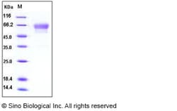 Sino Biological Mouse Podoplanin / PDPN Protein (His & Fc Tag) 100ug, Quantity: