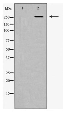 Amsbio LLC&nbsp;Fibronectin (FN1) Rabbit Polyclonal Antibody
