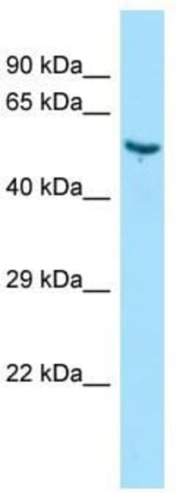 Amsbio LLC&nbsp;Vitronectin (VTN) Rabbit Polyclonal Antibody