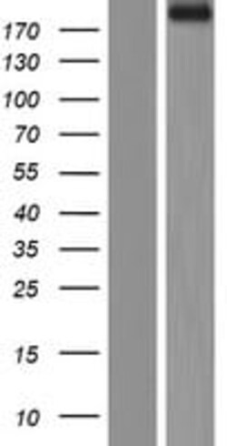 Amsbio LLC&nbsp;Fibronectin (FN1) (NM_212482) Human Tagged ORF Clone