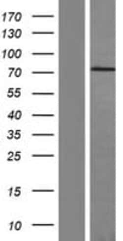 Amsbio LLC&nbsp;Fibronectin (FN1) (NM_054034) Human Tagged ORF Clone