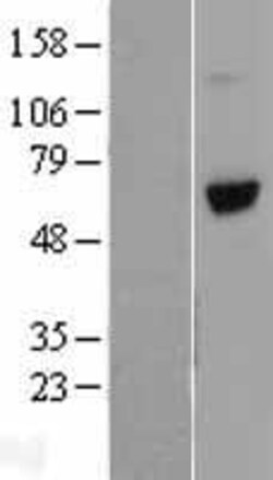 Amsbio LLC&nbsp;Vitronectin (VTN) (NM_000638) Human Tagged ORF Clone