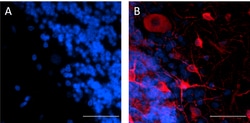 Biolegend&nbsp;Purified anti-MAP2 [1D7-B9-C8-F6]; Isotype: Mouse IgG2b, κ; Reactivity: Mouse, Human; Apps: IHC-P, WB; Size: 100 μg