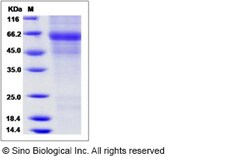 Sino Biological Recombinant Mouse Protein C Protein (His Tag), Quantity: