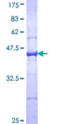 Abcam&nbsp;Recombinant Human C3 protein, 10UG