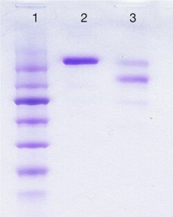 Abcam&nbsp;Human IgE protein, 1MG