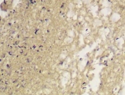 Abcam&nbsp;Gram Stain Kit (Microorganism Stain)