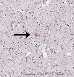 Abcam&nbsp;Congo Red Stain Kit (Amyloid Stain)