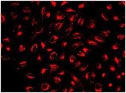 Abcam&nbsp;Cell Tracking Dye Kit   Deep Red   Cytopainter