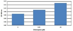 Abcam&nbsp;Hepatic Lipid Accumulation Steatosis Assay Kit