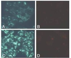 Abcam AutophagyCytotoxicity Dual Staining Kit