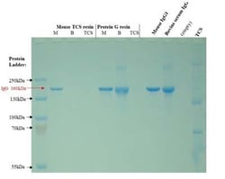 Abcam&nbsp;Mouse TCS Antibody Purification Kit, 1 Tests