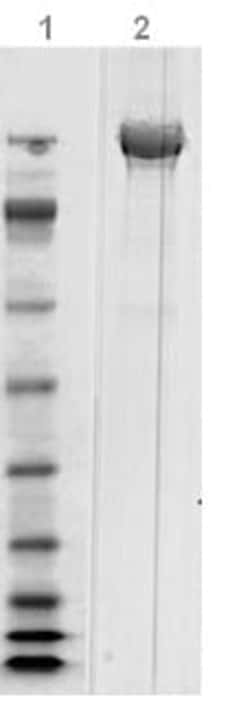 Abcam Native Clostridium difficile Toxoid B protein, 50UG