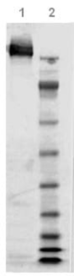 Abcam Native Clostridium difficile Toxoid A protein, 50UG