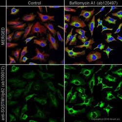 Abcam&nbsp;Bafilomycin A1, (V)-ATPase inhibitor, 100UG