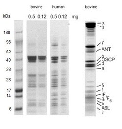 Abcam ATP Synthase Immunocapture Kit