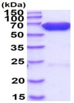 Abcam Recombinant Firefly Luciferase protein, 500UG