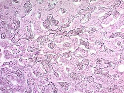 Abcam Reticulum Stain Kit (Modified Gomori's)