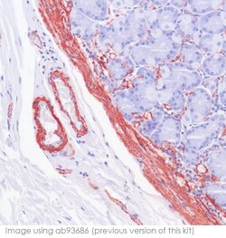 Abcam&nbsp;Mouse and Rabbit Specific HRP/AEC IHC Detection Kit - Micro-polymer, 125ML