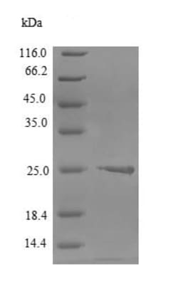 Abcam&nbsp;Recombinant Human Claudin 6 protein (Tagged), 10UG