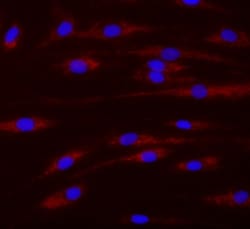 Abcam&nbsp;TMRM Assay Kit (Mitochondrial Membrane Potential)