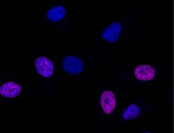 Abcam EdU Assay  EdU Staining Proliferation Kit (iFluor 647)
