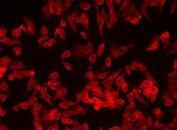 Abcam Cell Plasma Membrane Staining Kit   Orange Fluorescence   Cytopainter